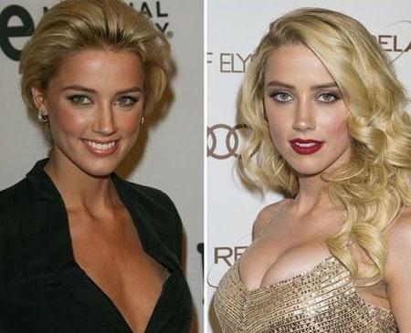 A picture of Amber Heard before (left) and after (right).